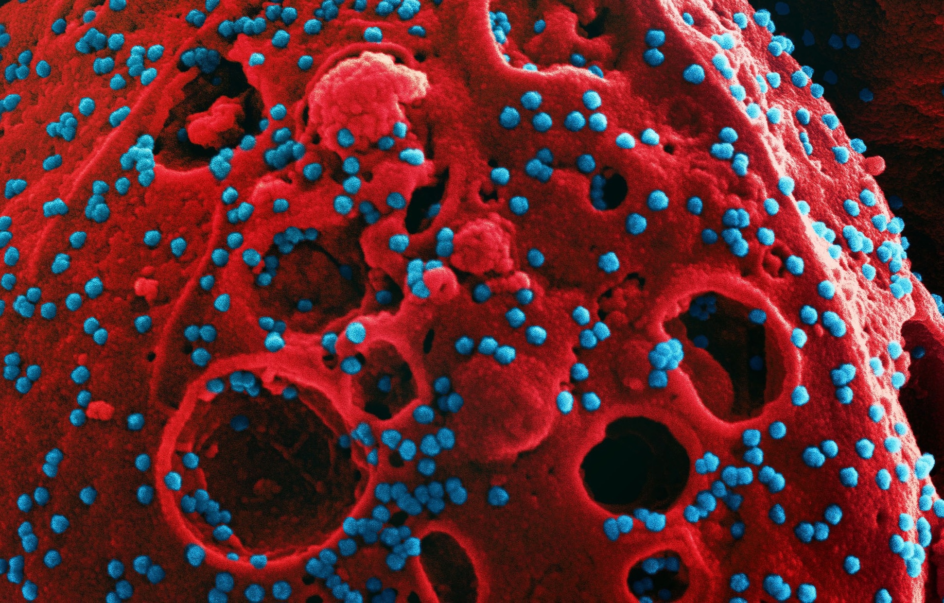 Correspondance: Antigenic mapping of emerging SARS-CoV-2 omicron variants BM.1.1.1, BQ.1.1, and XBB.1. Image Credit: NIAID