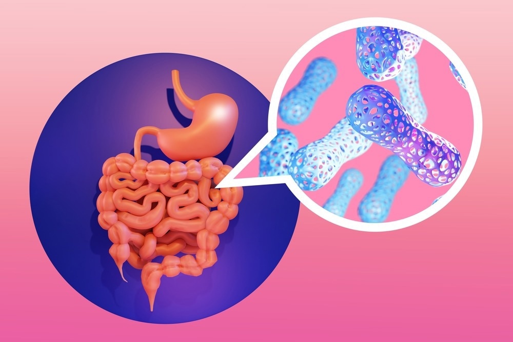 Study: Variation of butyrate production in the gut microbiome in type 2 diabetes patients. Image Credit: FOTOGRIN / Shutterstock.com