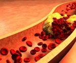 Review highlights the effectiveness of diet-based low-density lipoprotein lowering over medication