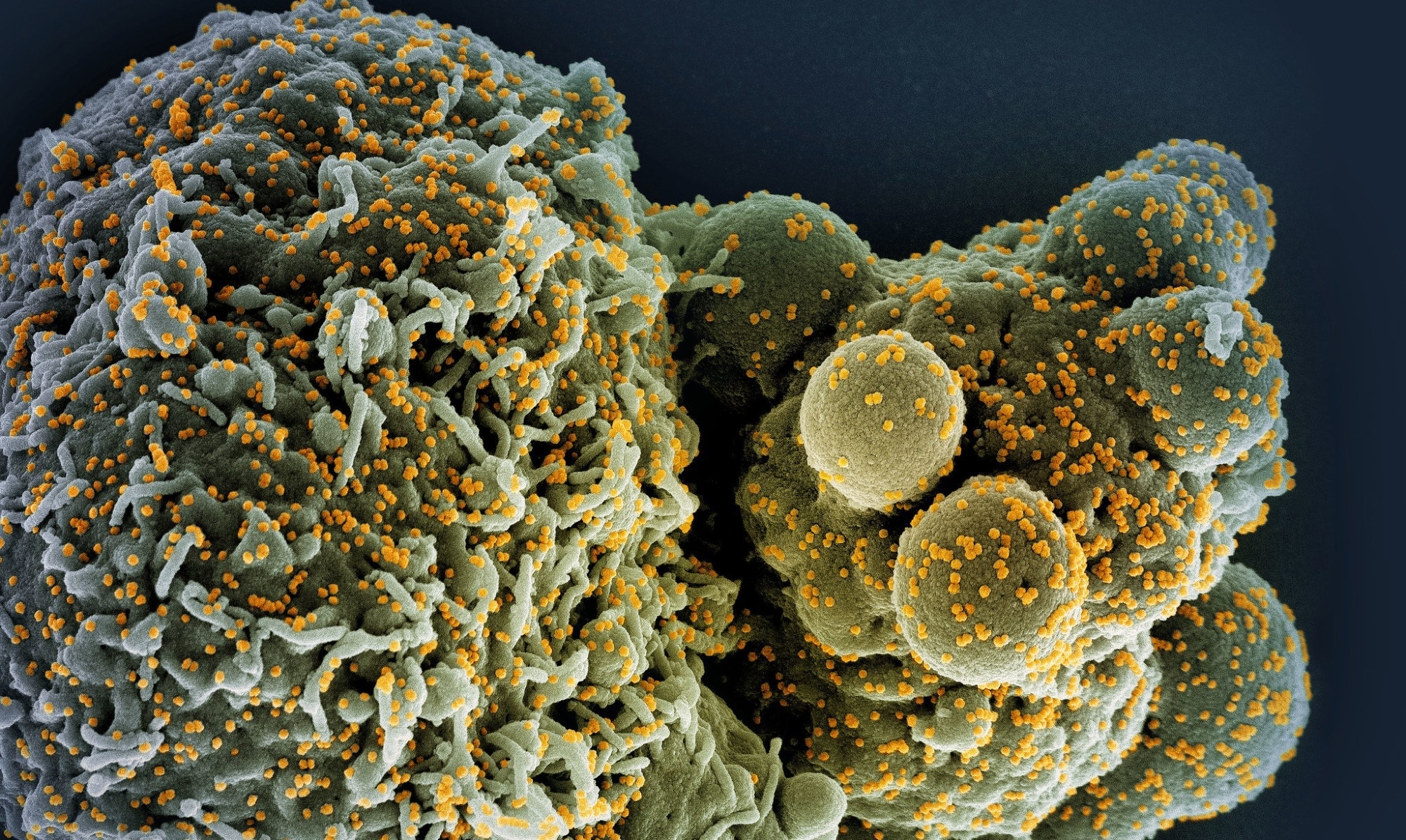 Study: A replicon RNA vaccine can induce durable protective immunity from SARS-CoV-2 in nonhuman primates after neutralizing antibodies have waned. Image Credit: NIAID