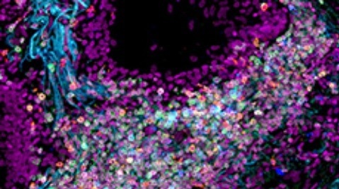 Researchers create first integrated single-cell atlas of the human lung