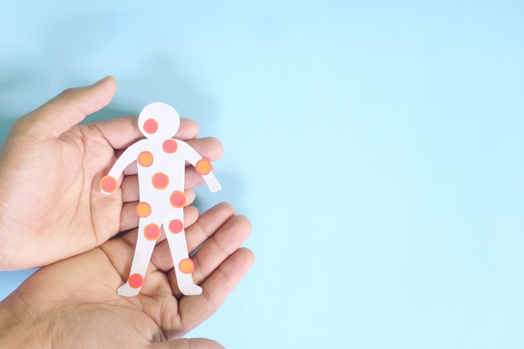 Study: Deep learning based detection of monkeypox virus using skin lesion images. Image Credit: sulit.photos/Shutterstock.com