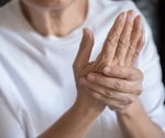 Can yoga alleviate rheumatoid arthritis severity?