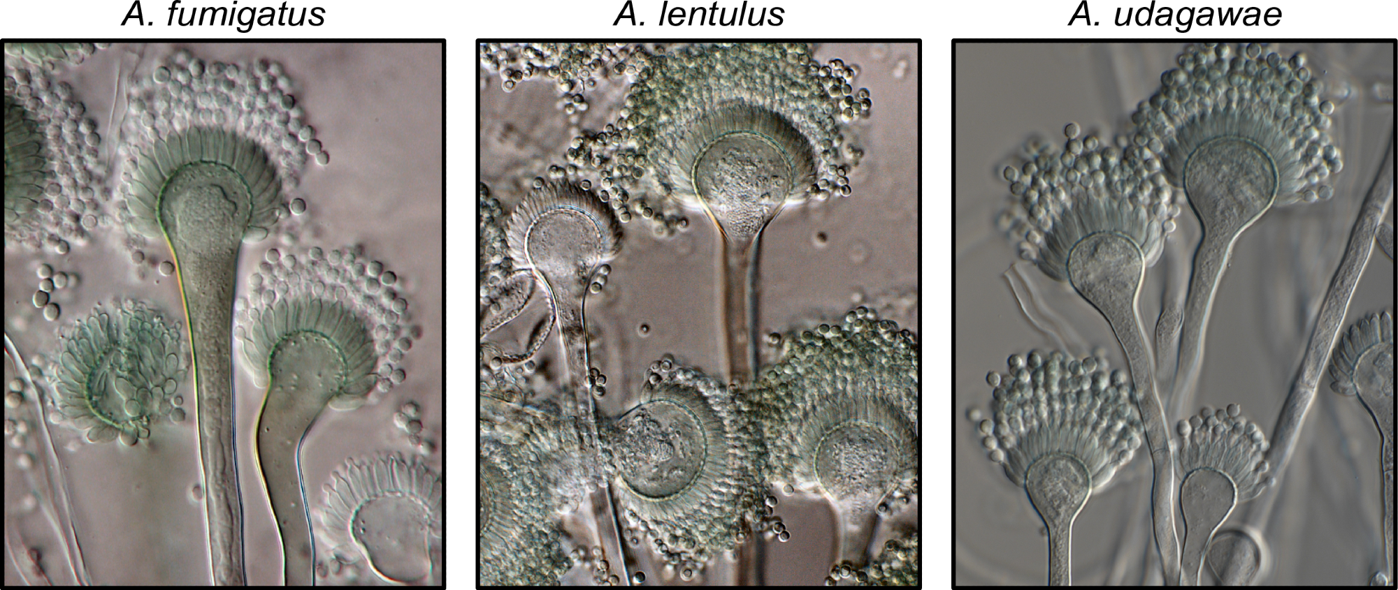 Exemplary known and cryptic pathogenic species of Aspergillus. (Left) Aspergillus fumigatus is a well-known and major human fungal pathogen. The cryptic species (Middle) Aspergillus lentulus and (Right) Aspergillus udagawae can also cause human disease but may be difficult to diagnose owing to their morphological similarity to A. fumigatus. Images were kindly provided by Dr. Jos Houbraken. https://doi.org/10.1371/journal.ppat.1011704.g001
