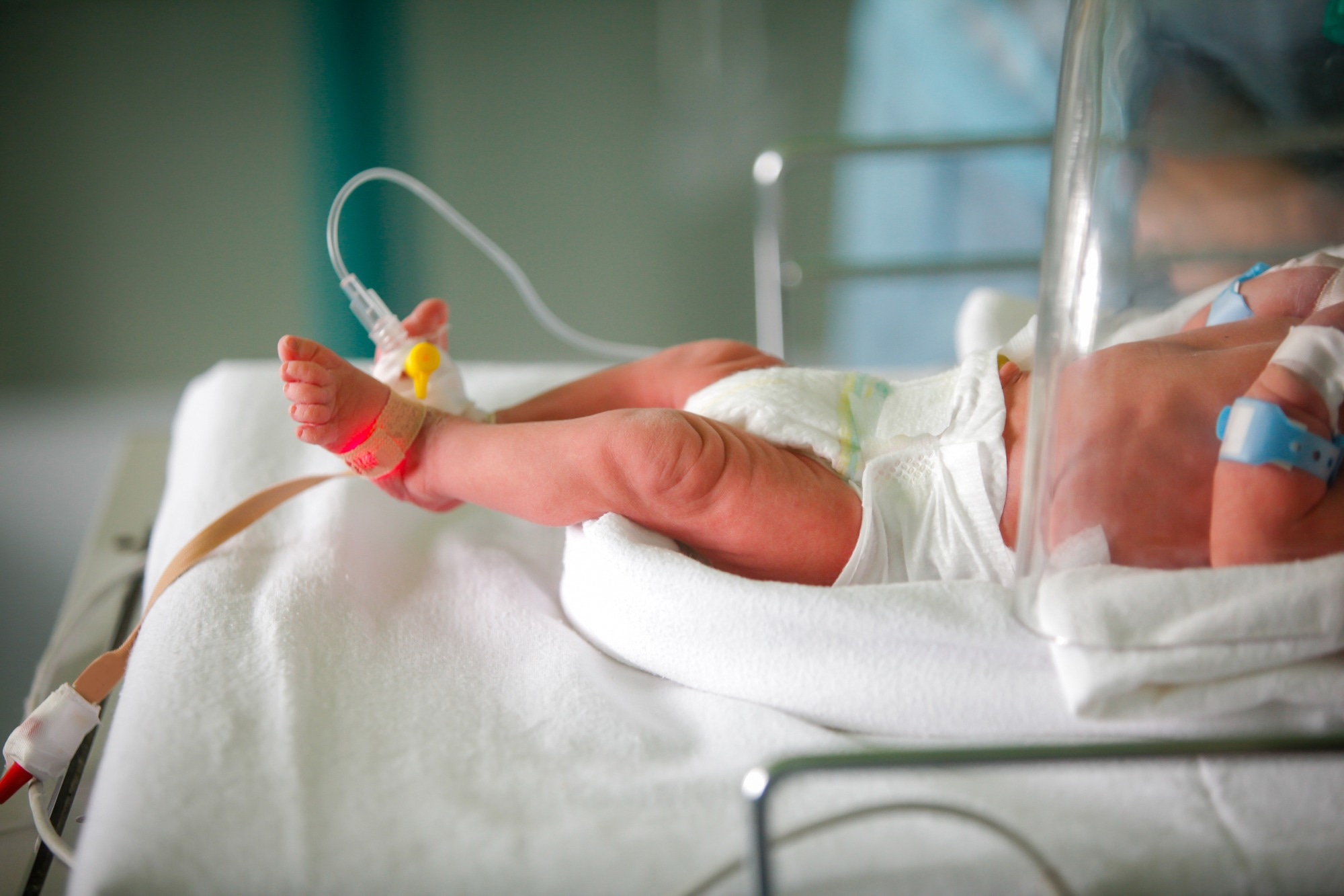 Study: Blockade of IL-6R prevents preterm birth and adverse neonatal outcomes. Image Credit: Mircea Moira/Shutterstock.com