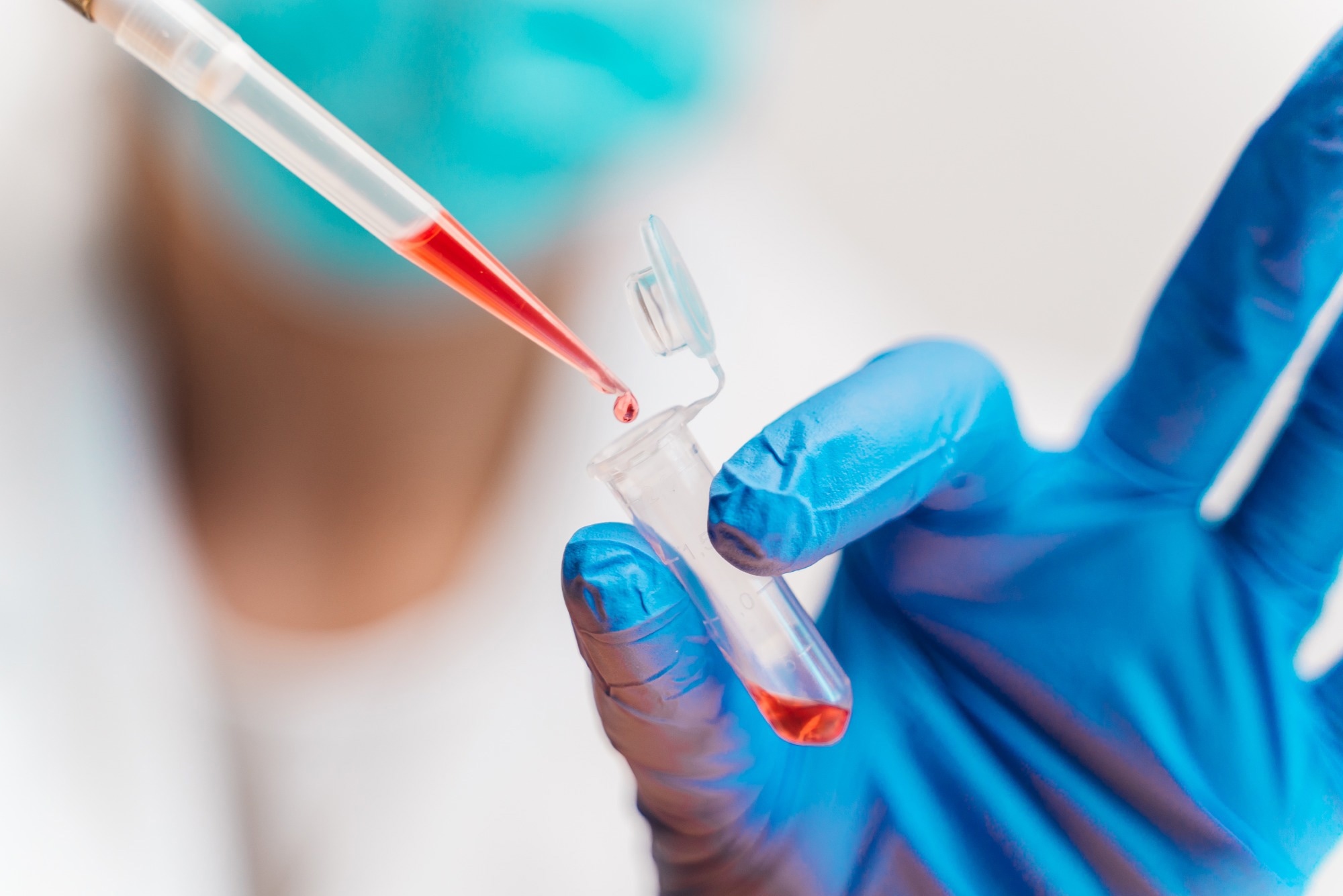 Study: Platform-independent estimation of human physiological time from single blood samples. Image Credit: Nuva Frames / Shutterstock