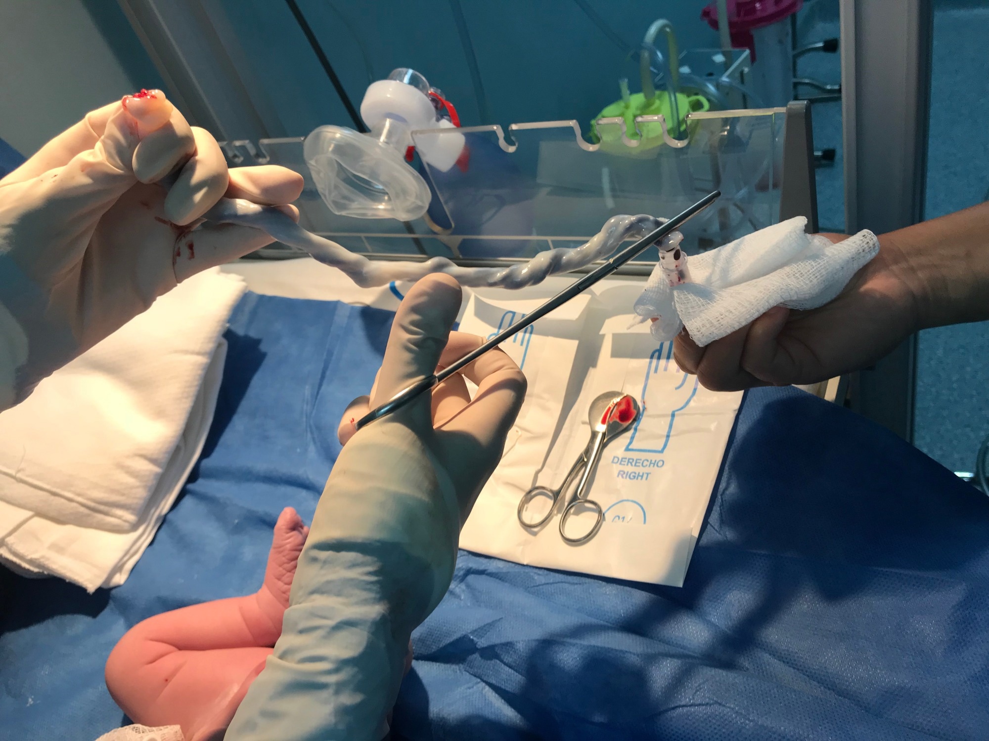 ​​​​​​​Study: Cord blood lipid correlation network profiles are associated with subsequent attention-deficit/hyperactivity disorder and autism spectrum disorder symptoms at 2 years: a prospective birth cohort study. Image Credit: LOLA61/Shutterstock.com