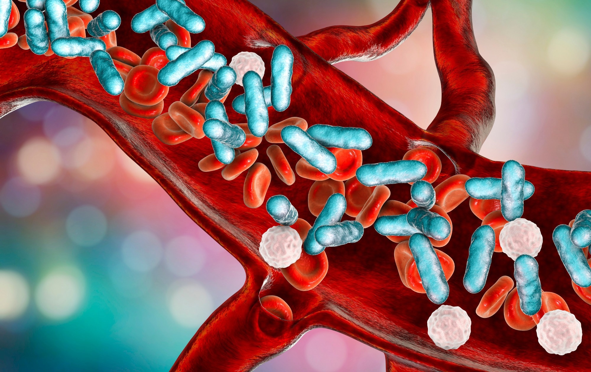 Impact of a deep learning sepsis prediction model on quality of care and survival