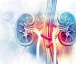 New model predicts kidney injury risk in cancer patients on cisplatin