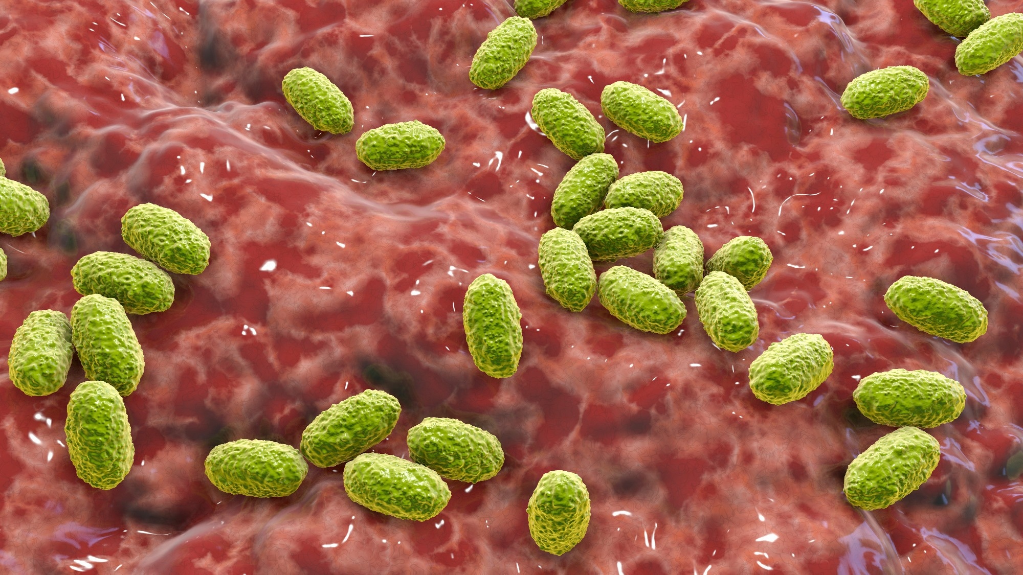 Study: Pertussis epidemic in Denmark, August 2023 to February 2024. Image Credit: Kateryna Kon / Shutterstock.com