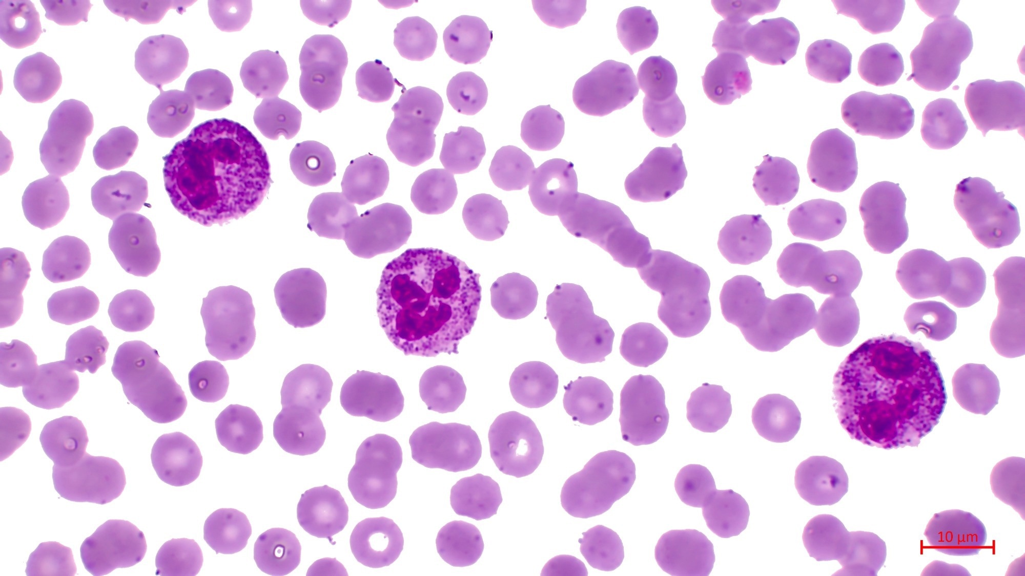 Study: Analysis of somatic mutations in whole blood from 200,618 individuals identifies pervasive positive selection and novel drivers of clonal hematopoiesis. Image Credit: BioFoto / Shutterstock