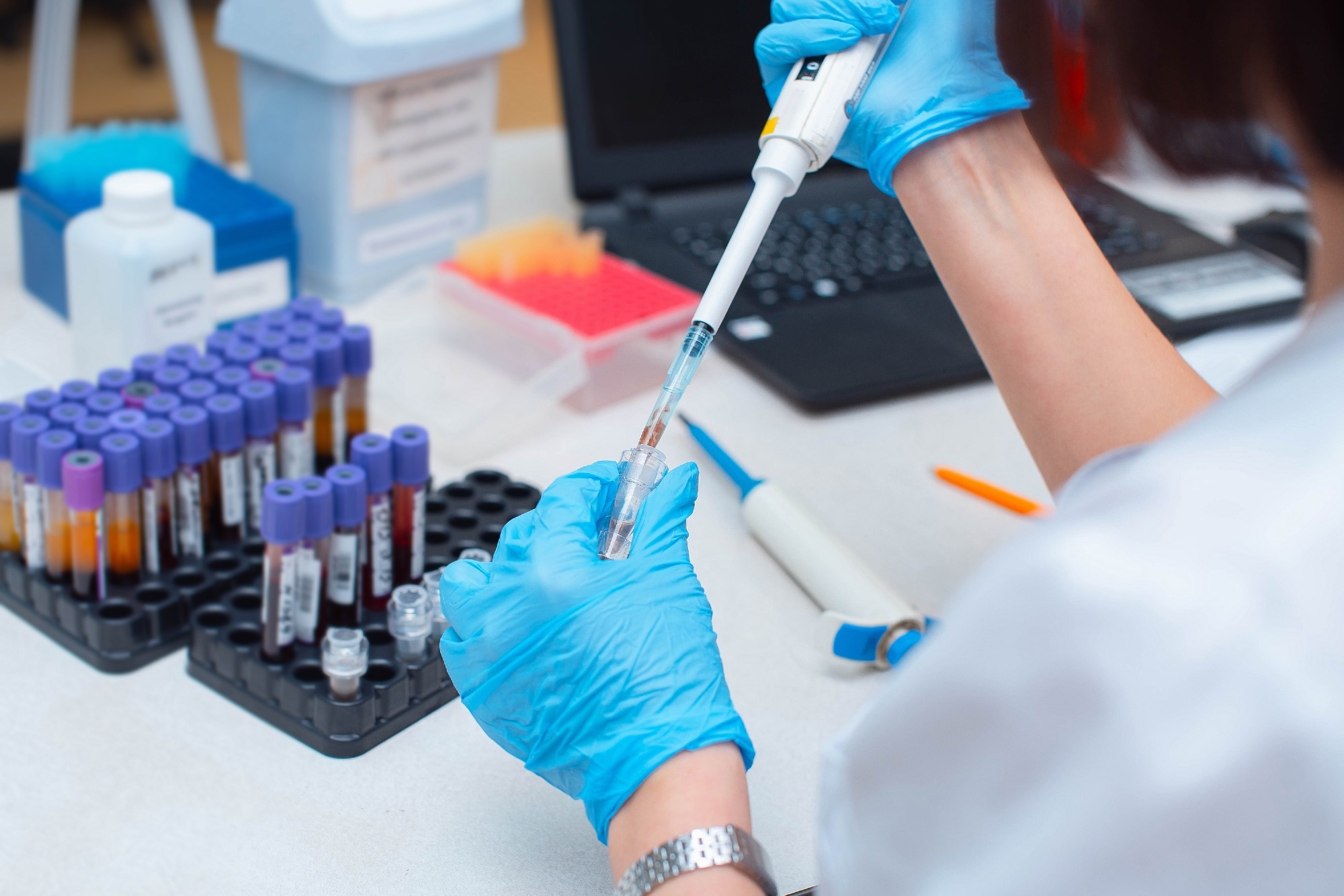 ​​​​​​​Study: Vaccination induces broadly neutralizing antibody precursors to HIV gp41. Image Credit: Salov Evgeniy/Shutterstock.com