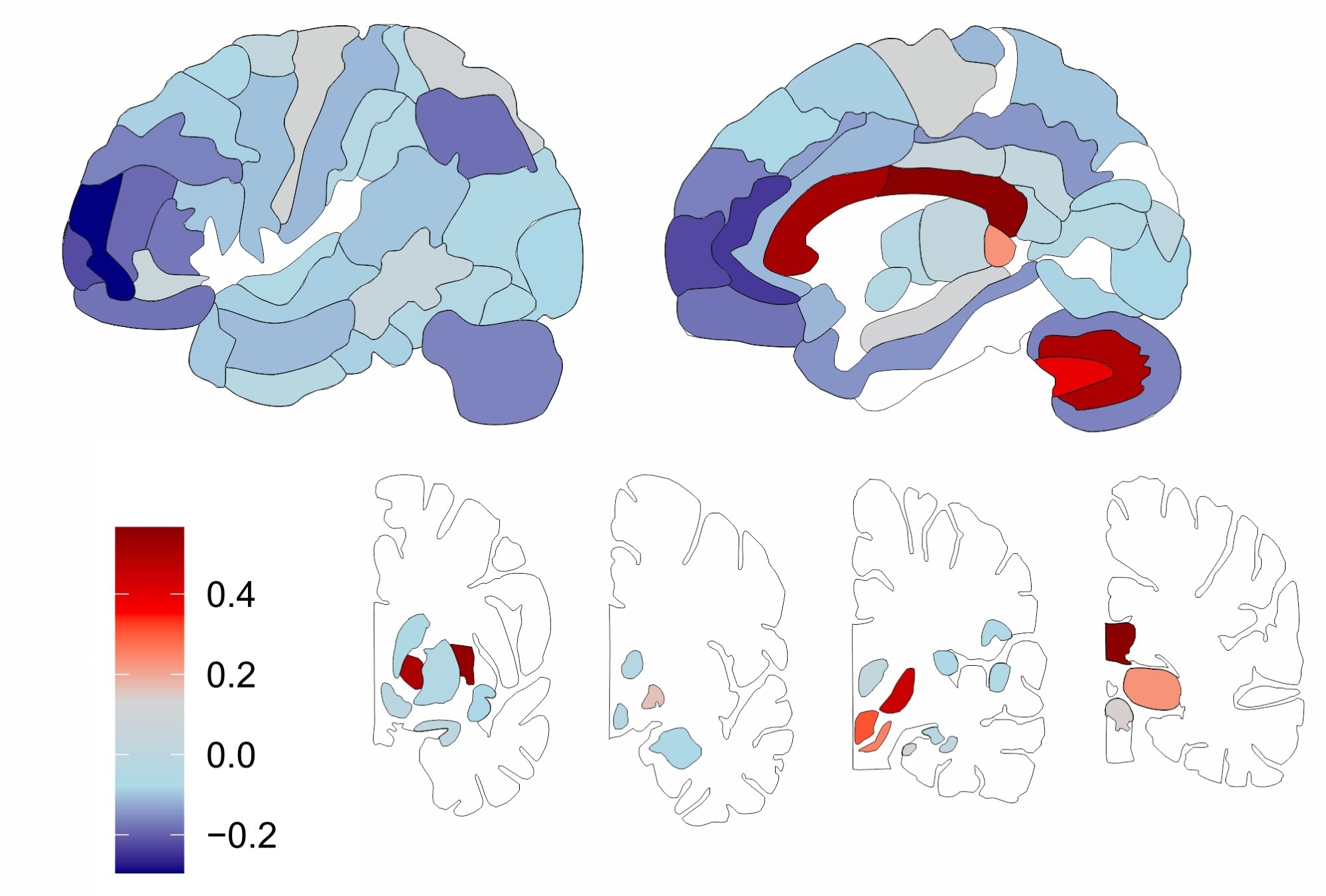 World’s first map of human brain lipids created