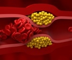 How lipoproteins shape your metabolic health