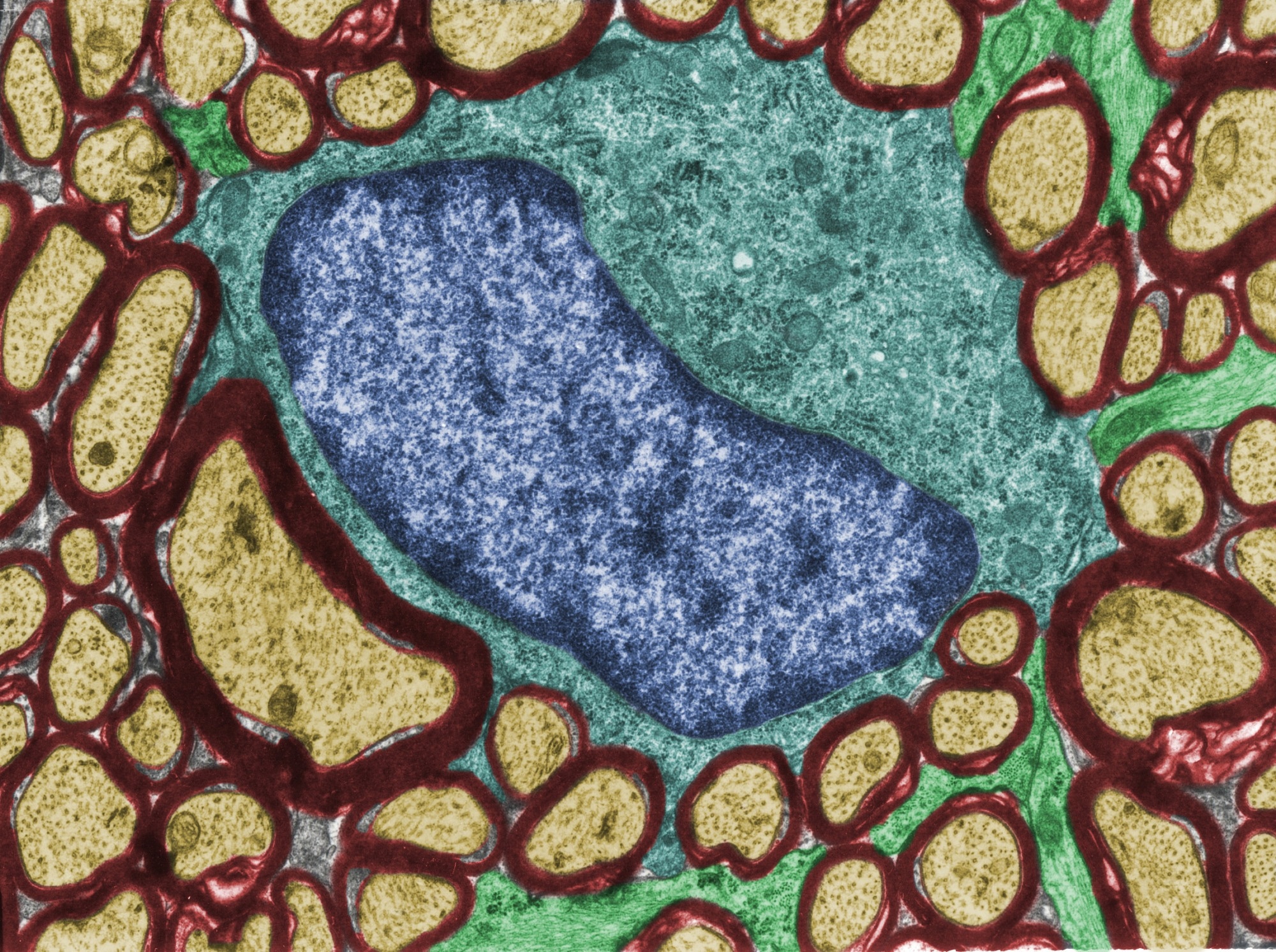 Study: Oligodendrocytes produce amyloid-β and contribute to plaque formation alongside neurons in Alzheimer’s disease model mice. Image Credit: Jose Luis Calvo / Shutterstock