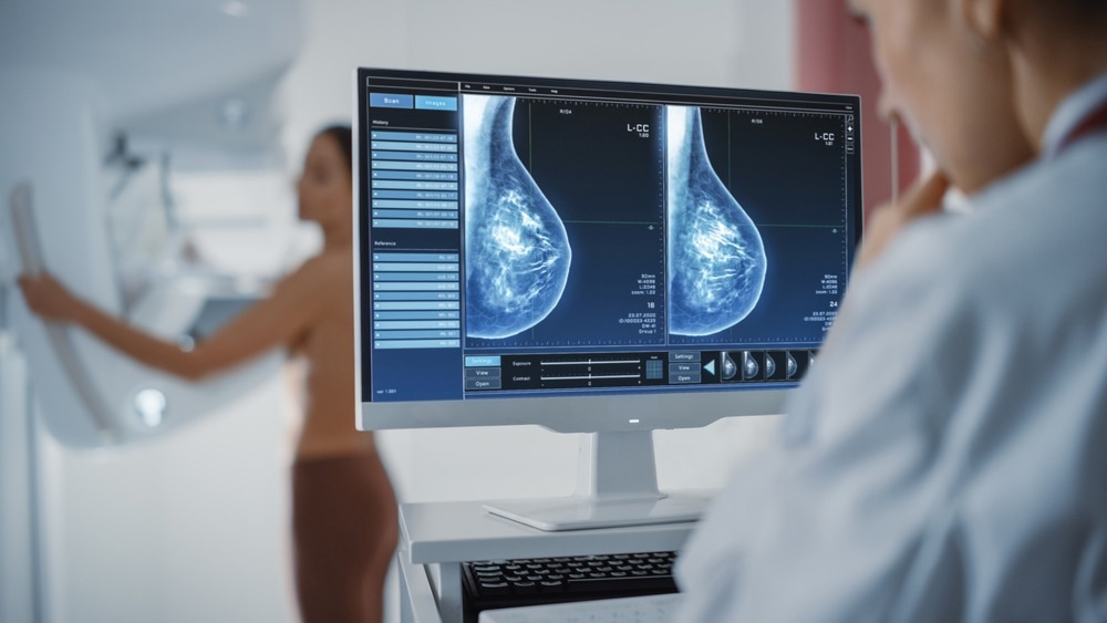 Study: Lipidomics and metabolomics as potential biomarkers for breast cancer progression. Image Credit: Gorodenkoff/Shutterstock.com