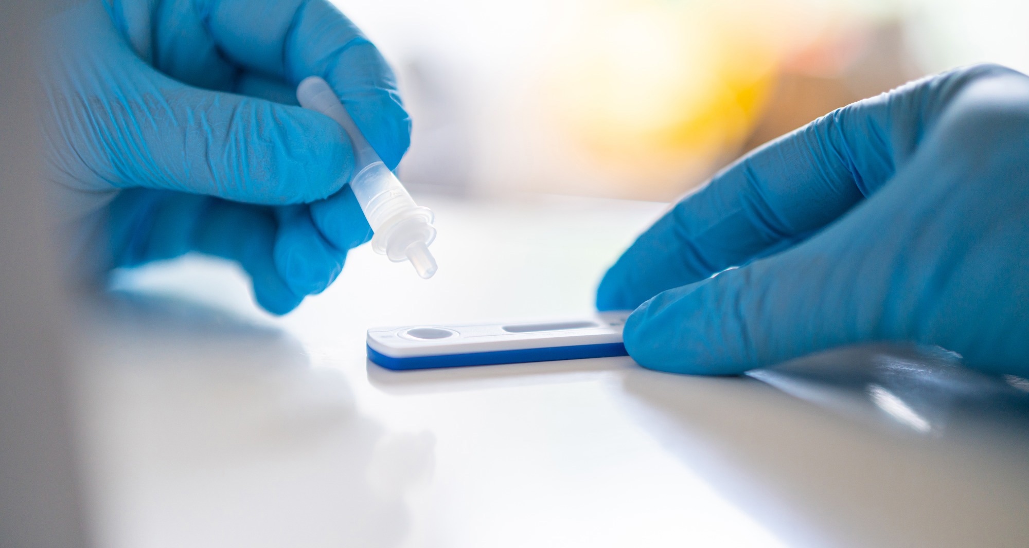 Study: Health outcomes 3 months and 6 months after molnupiravir treatment for COVID-19 for people at higher risk in the community (PANORAMIC): a randomised controlled trial. Image Credit: Audio und werbung / Shutterstock