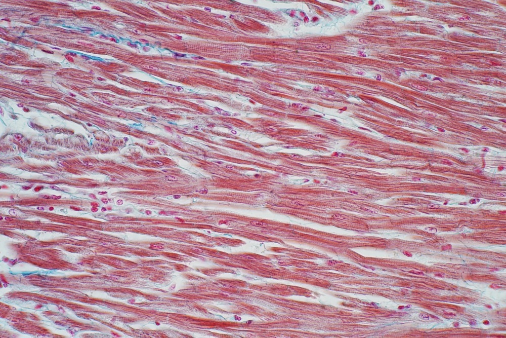 Study: Targeting immune–fibroblast cell communication in heart failure. Image Credit: Choksawatdikorn/Shutterstock.com