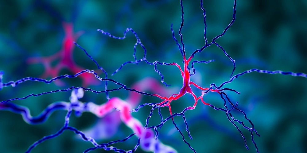 Study: Neuroprotective effect of neuron-specific deletion of the C16 ceramide synthetic enzymes in an animal model of multiple sclerosis. Image Credit: Kateryna Kon/Shutterstock.com