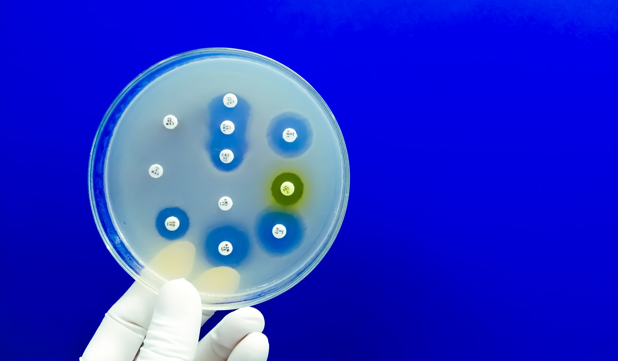 Petri dish containing antibiotic resistance