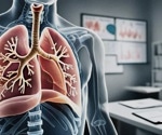 Nanozyme breakthrough offers new hope for viral pneumonia treatment