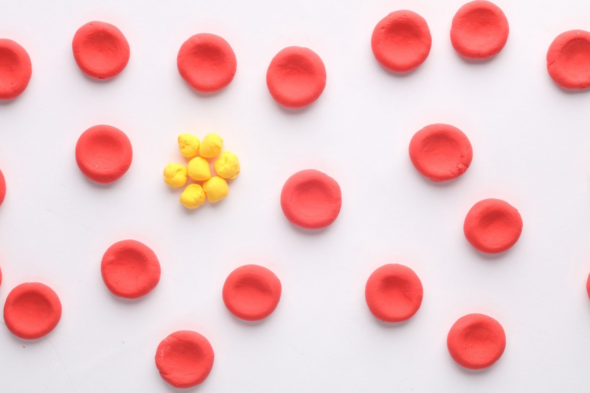 Study: Integration of lipidomics with targeted, single cell, and spatial transcriptomics defines an unresolved pro-inflammatory state in colon cancer. Image Credit: Vladimir Sukhachev / Shutterstock