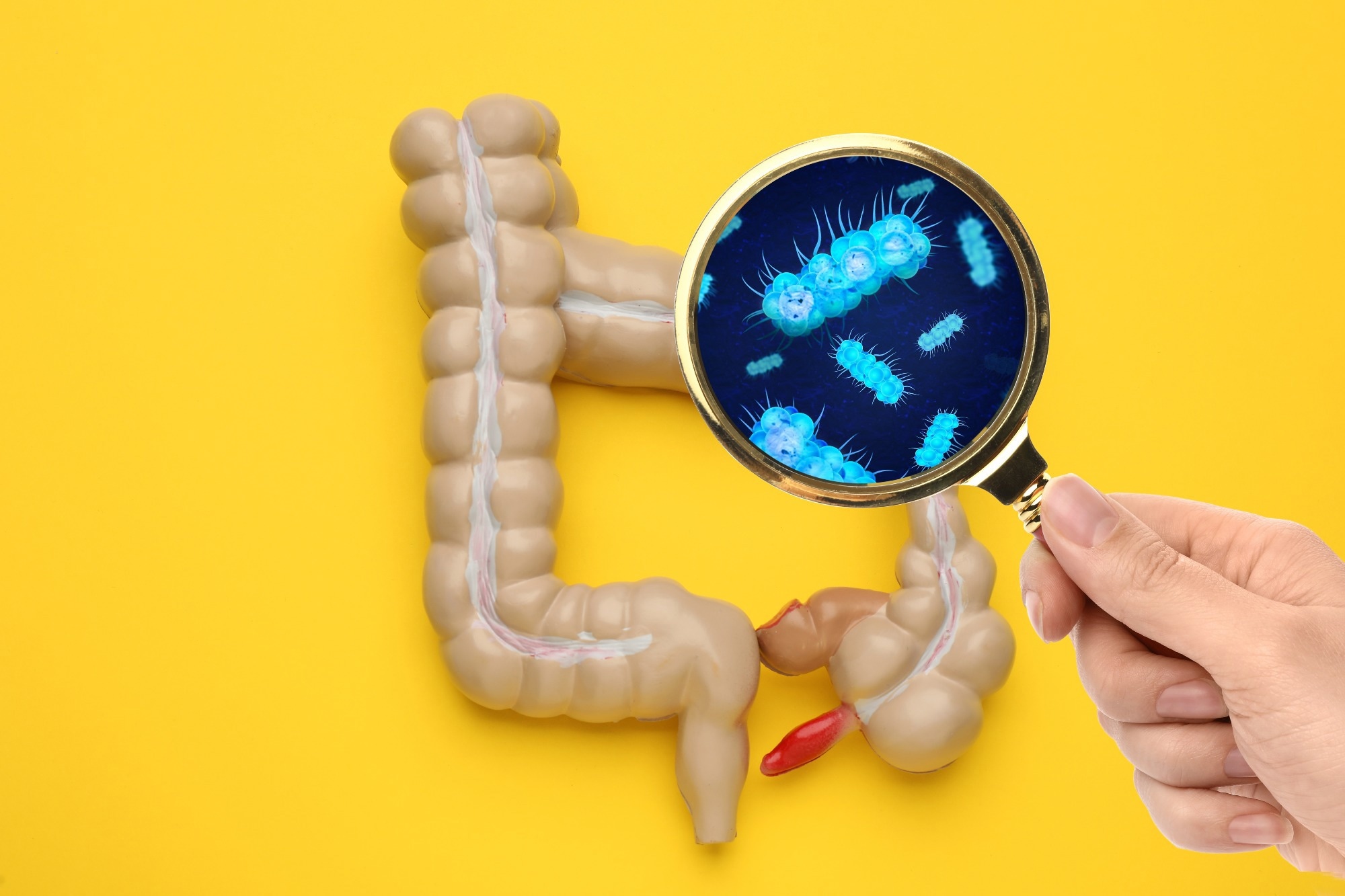 Study: Dairy Consumption and the Colonic Mucosa-Associated Gut Microbiota in Humans—A Preliminary Investigation. Image Credit: New Africa / Shutterstock