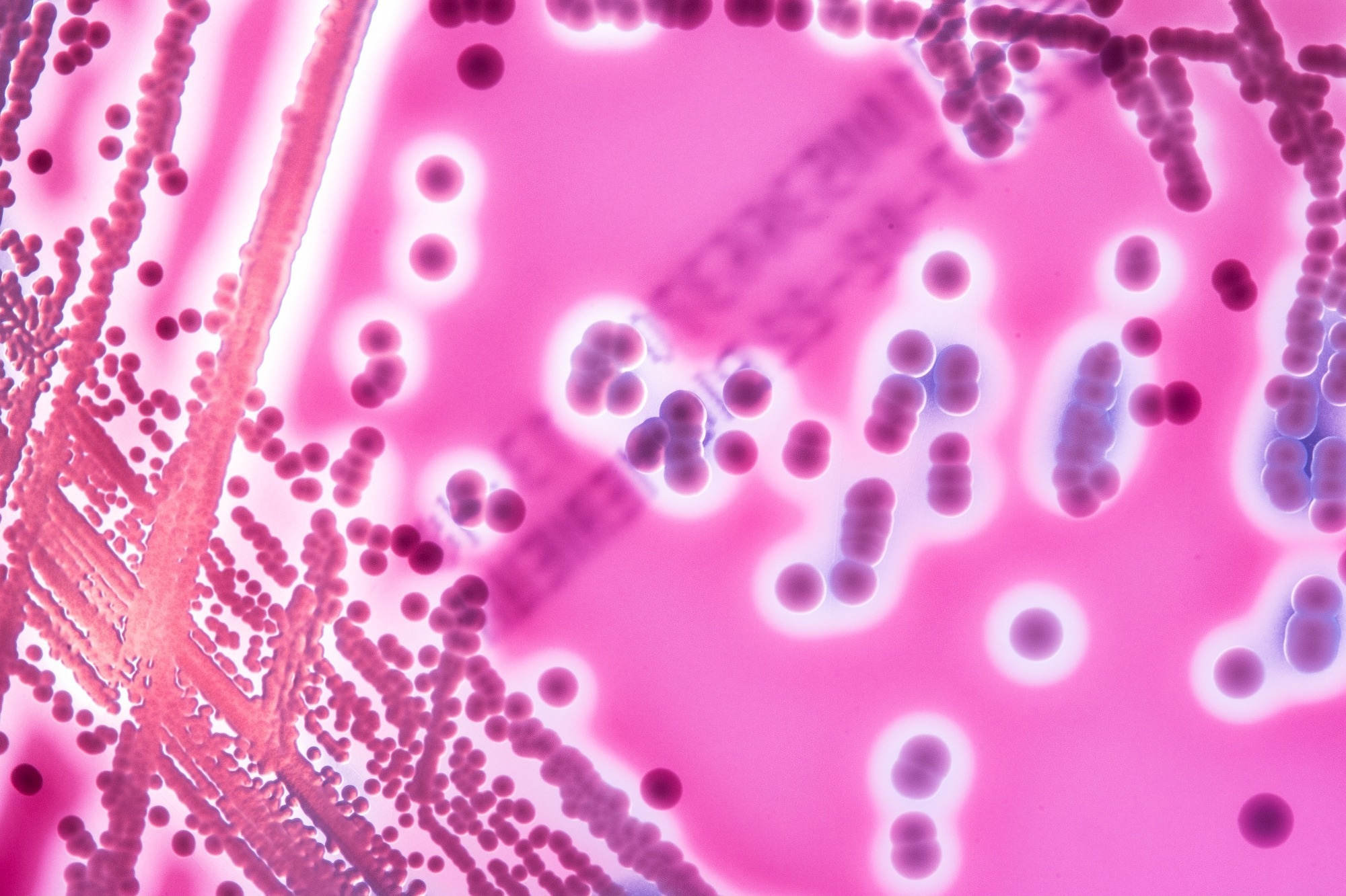 Study: The Impact of Human Salivary Amylase Gene Copy Number and Starch on Oral Biofilms. Image Credit: Stastny_Pavel / Shutterstock