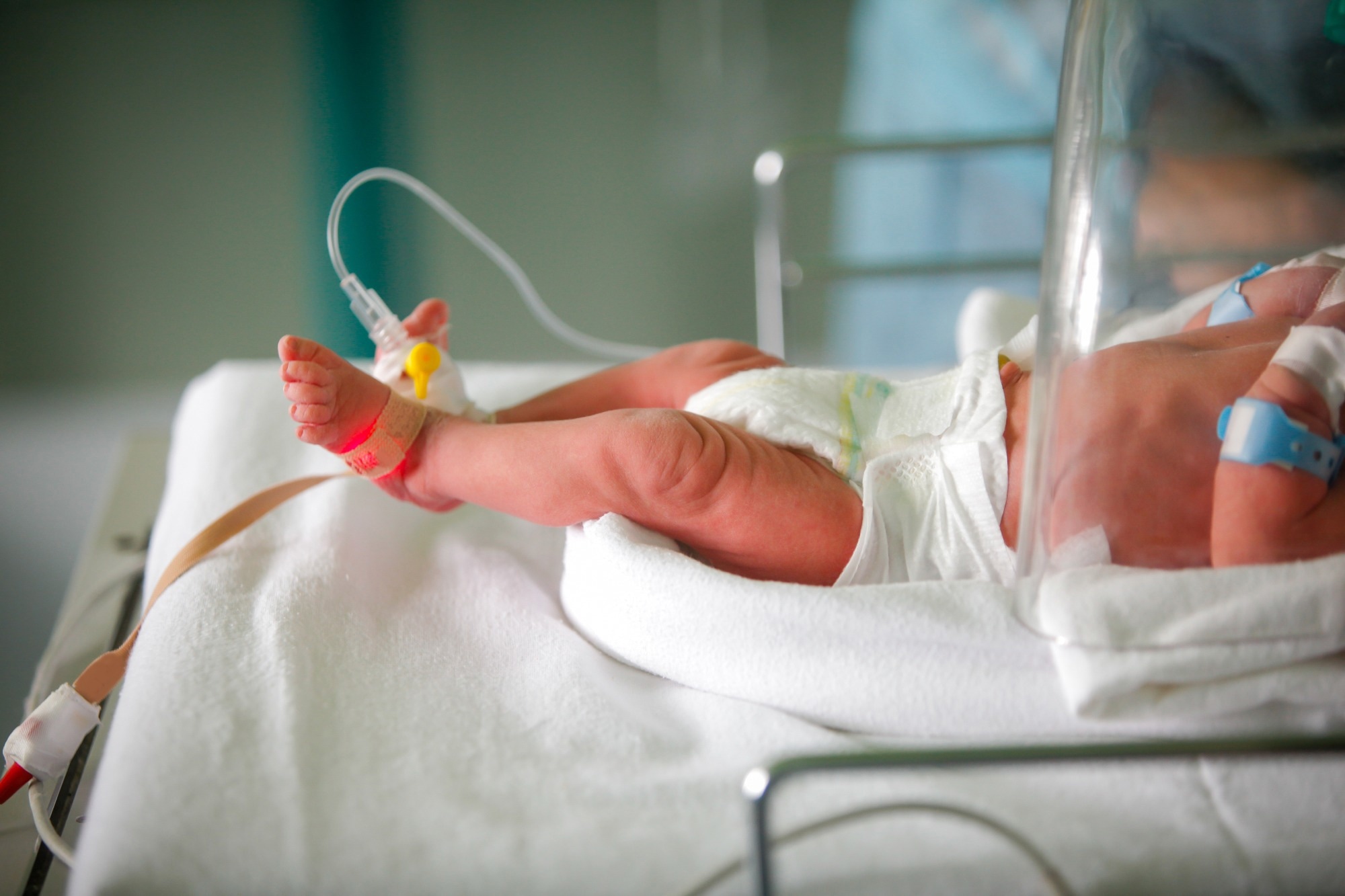 Study: Impact of early nutrition on brain development and neurocognitive outcomes in very preterm infants. Image Credit: Mircea Moira / Shutterstock