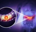 Vitamin D curbs colorectal cancer by boosting immunity and blocking tumor growth