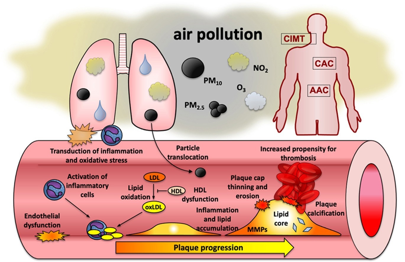 Review: Air pollution and atherosclerosis