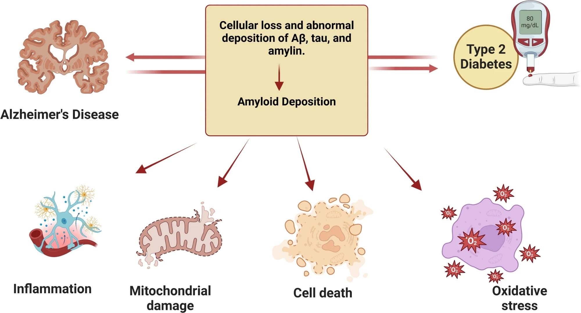 Diagram illustrating how Alzheimer’s disease and type 2 diabetes are linked by abnormal deposition of amyloid, tau, and amylin