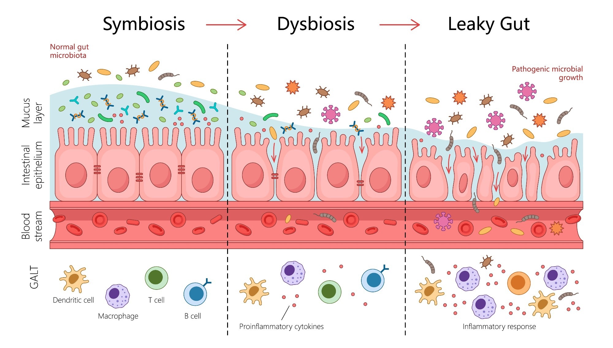Review: The role of the gut microbiota and metabolites in heart failure and possible implications for treatment. Image Credit: Alexander_P / Shutterstock