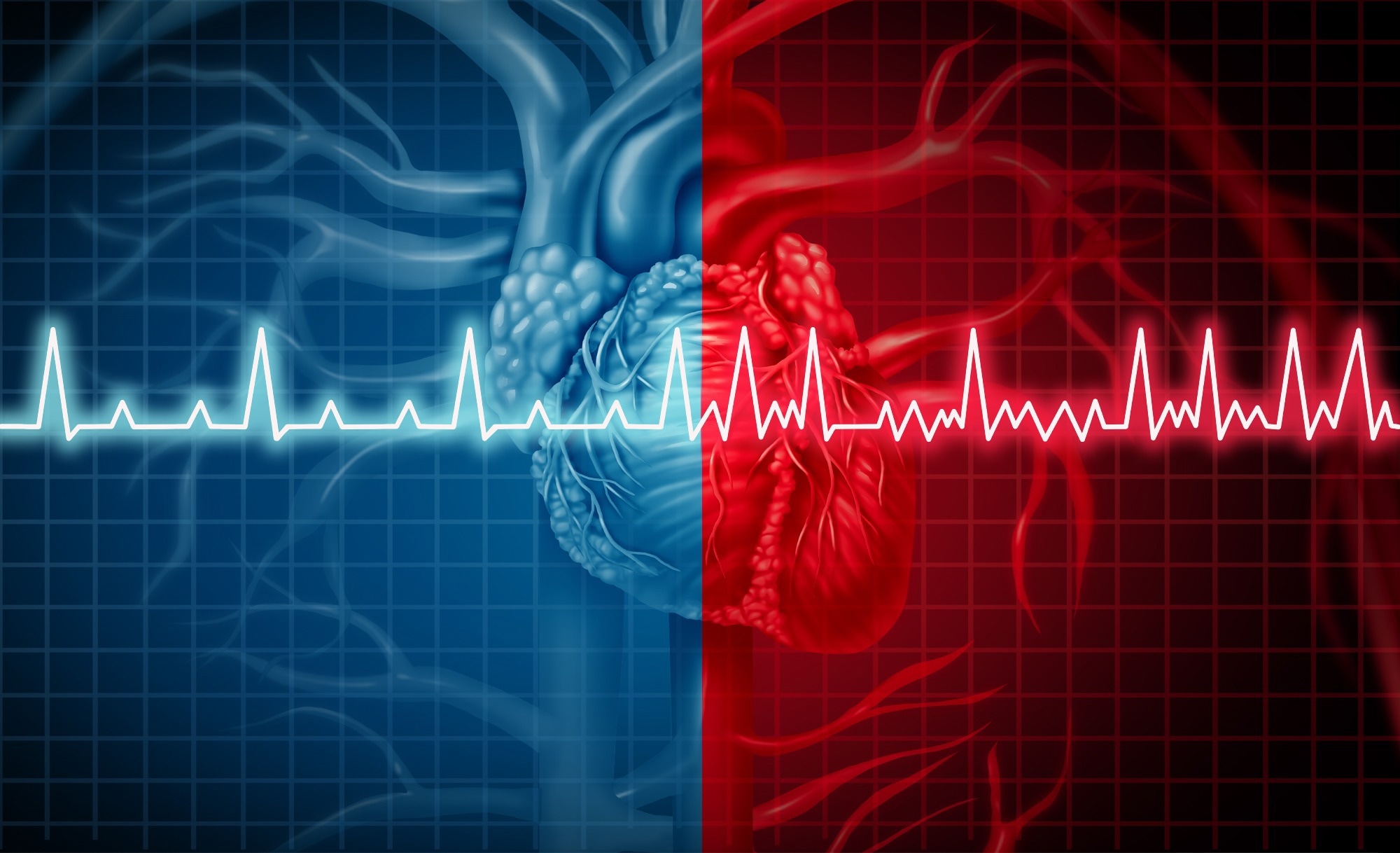 Study: Exercise based cardiac rehabilitation for atrial fibrillation: Cochrane systematic review, meta-analysis, meta-regression and trial sequential analysis. Image Credit: Lightspring / Shutterstock