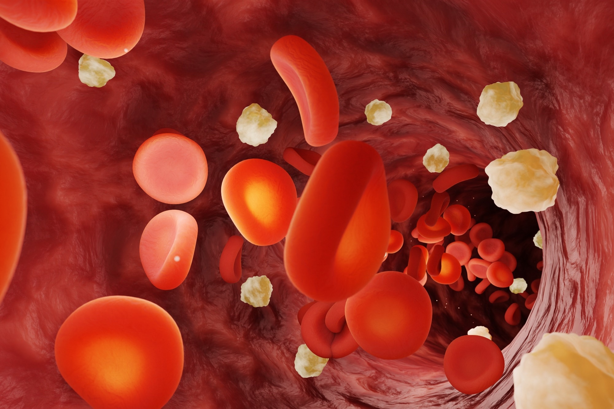 Study: Epigenetic biomarkers predict macrovascular events in individuals with type 2 diabetes. Image Credit: Dragon Claws / Shutterstock