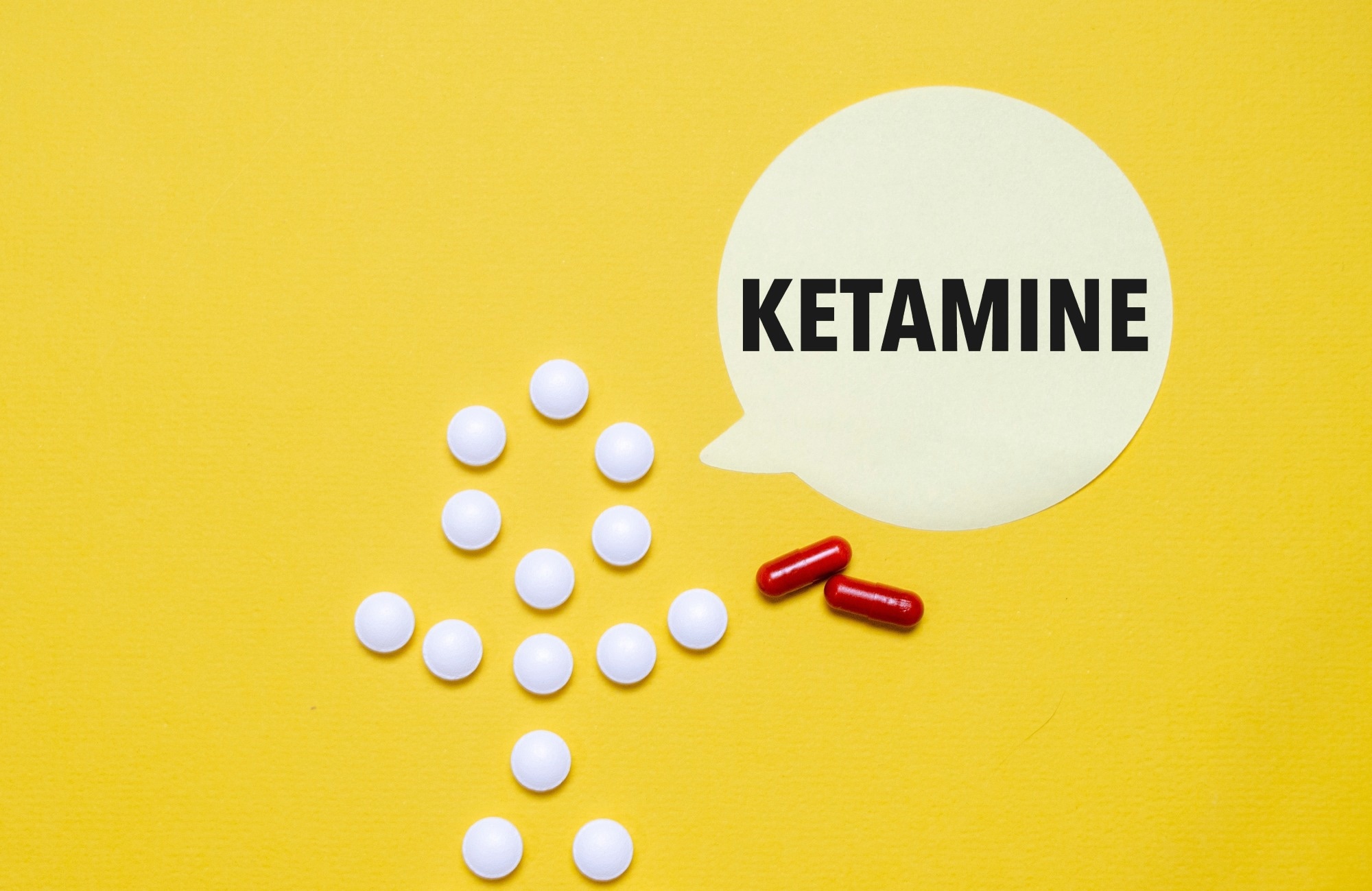 Review: Ketamine and other NMDA receptor antagonists for chronic pain. Image Credit: ANDREI ASKIRKA  / Shutterstock