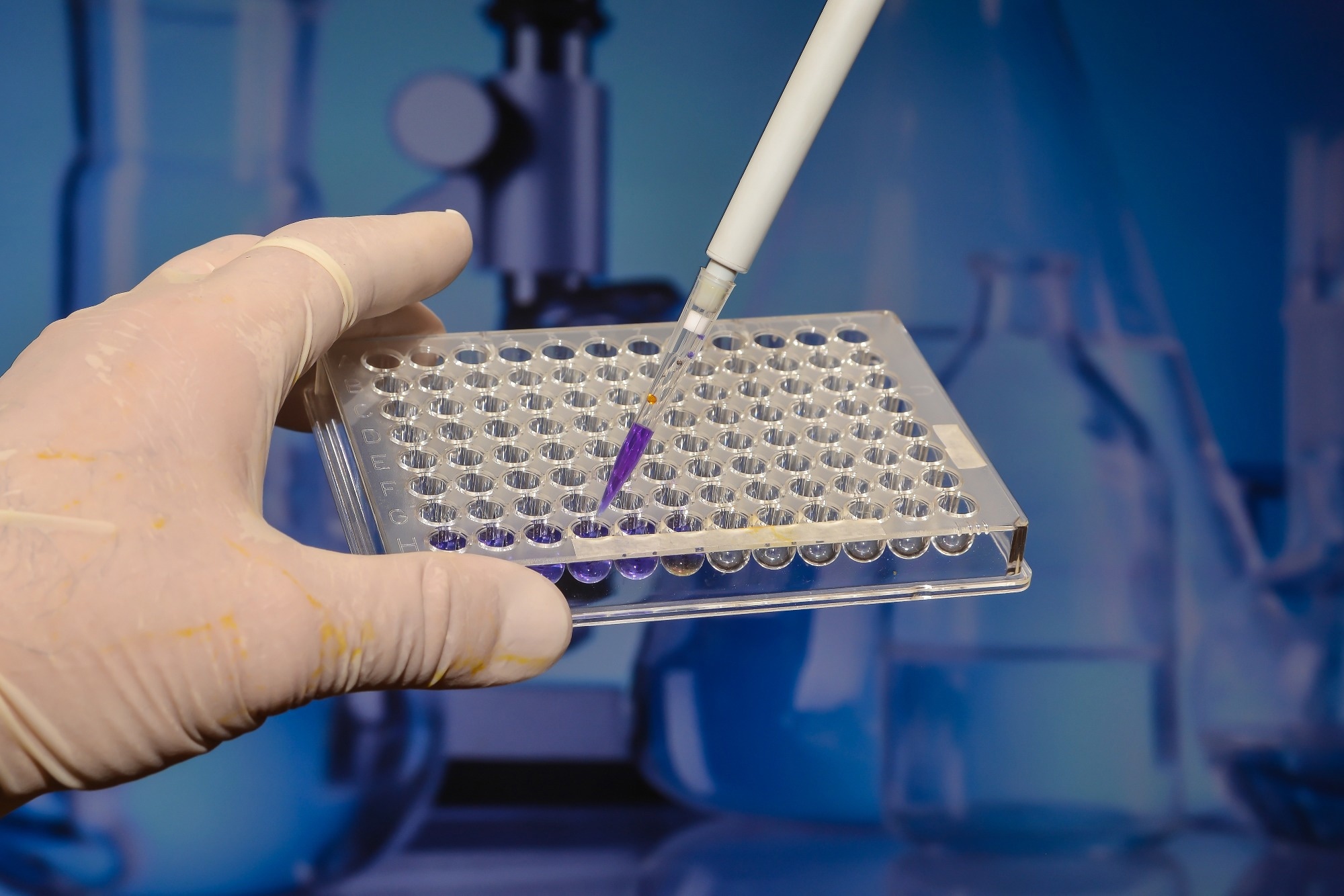 Study: Feasibility, acceptability and clinical outcomes of the BabyScreen+ genomic newborn screening study. Image Credit: Sergei Drozd / Shutterstock