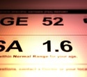 Study confirms PSA screening improves survival and safety