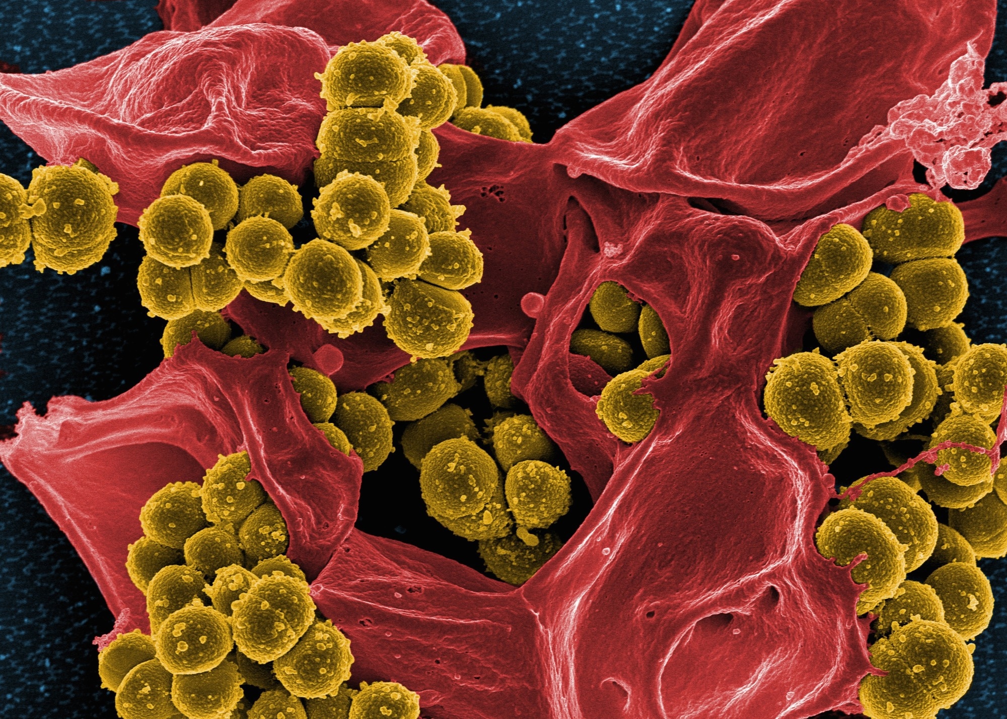 methicillin-resistant Staphylococcus aureus (MRSA) bacteria