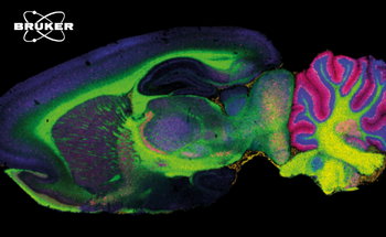 SpatialOMx - Mass Spectrometry and the Future of Spatial Biology