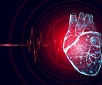 Cardiac device trial highlights importance of female representation in research