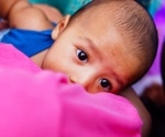Hypertensive disorders in pregnancy linked to lower breastfeeding rates
