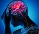 Global study reveals persistent burden of headache disorders