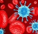 Immune dysfunction persists after combined TB and HIV therapy