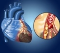 Successful root canal treatment benefits metabolic and heart health