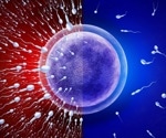 Causes of Male Infertility