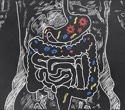 Gut bacteria produce immune-boosting compounds in response to tetracyclines