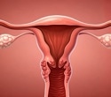 New menstrual blood test detects endometriosis with five times greater sensitivity