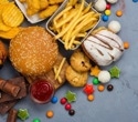 Ultra-processed foods linked to precursors of early-onset colorectal cancer