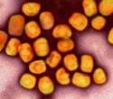 Global Virus Network accelerates mpox diagnostic research